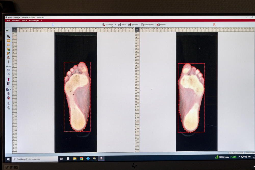 Prise d'empreintes et mesure du pied