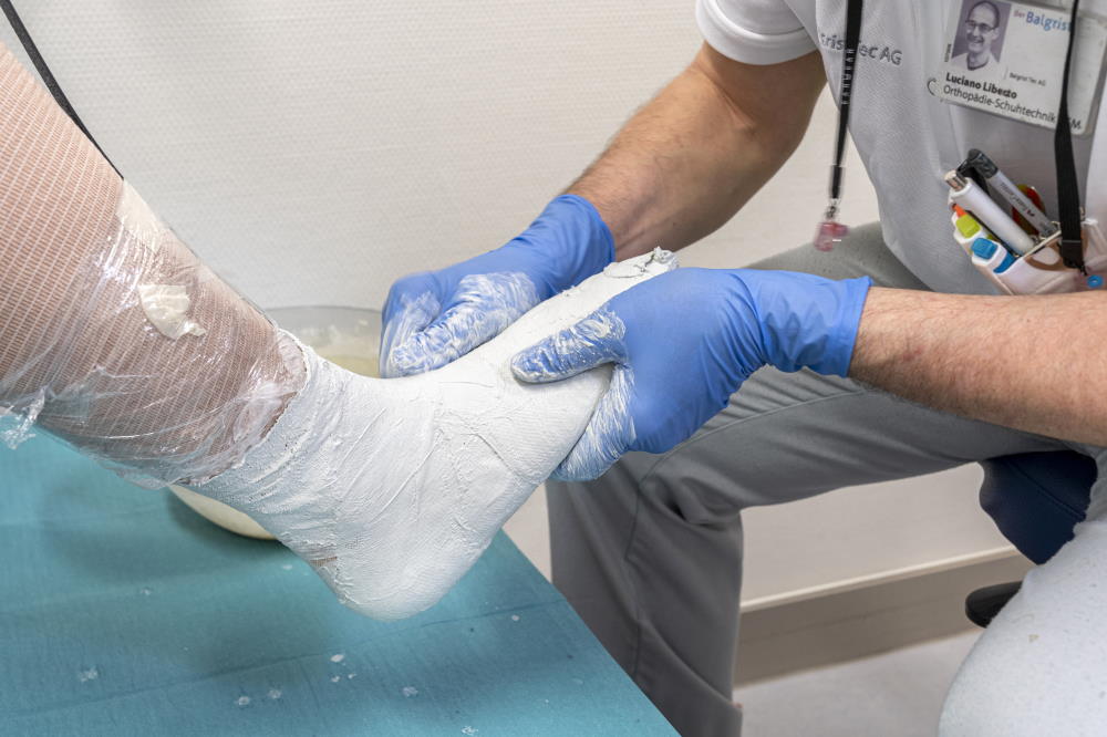 Moulage de la forme